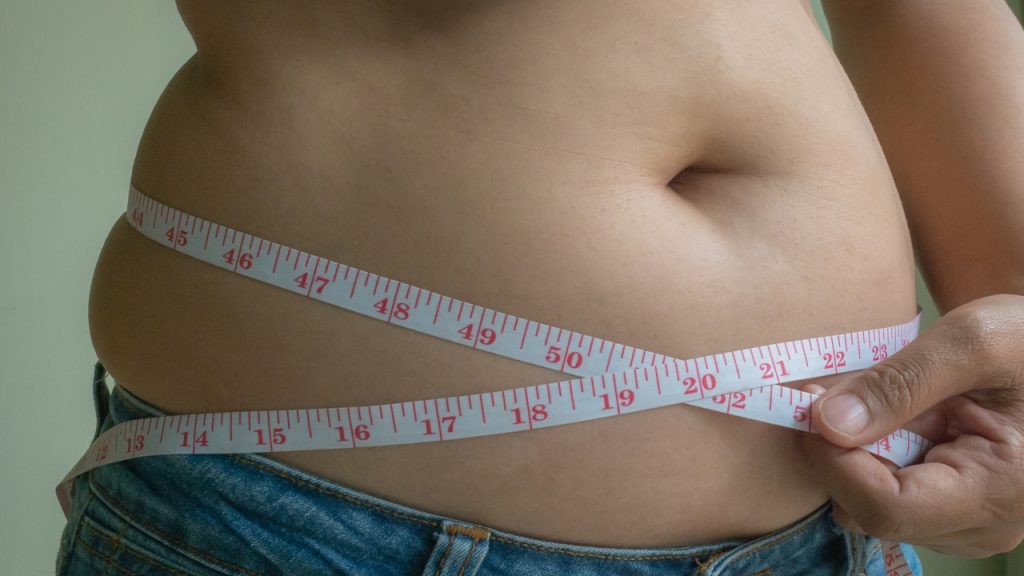 Excess kilos go unnoticed in the medical history of 40% of people with obesity